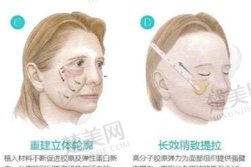 一、柳州华美整形医院:连锁大品牌,实力有保护