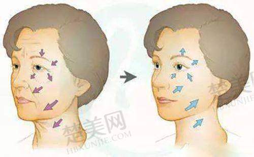 十、西安高一生医疗美容医院