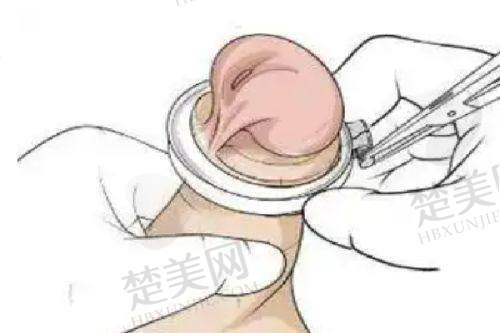 五、柳州华美整形医院其他优势：环境与服务并存