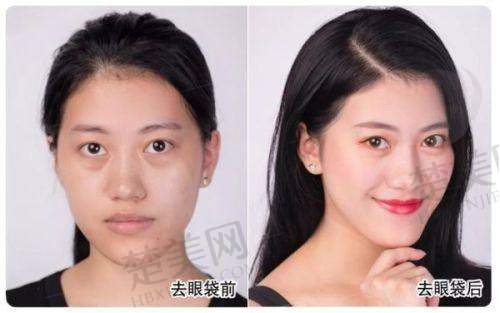五、成都素美医疗美容：用户口碑与总结