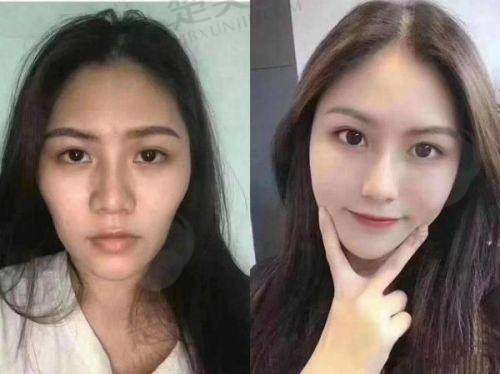 一、王明利医生做脂肪填充好吗？先看医生资历背景