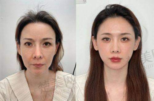 八、重庆美莱