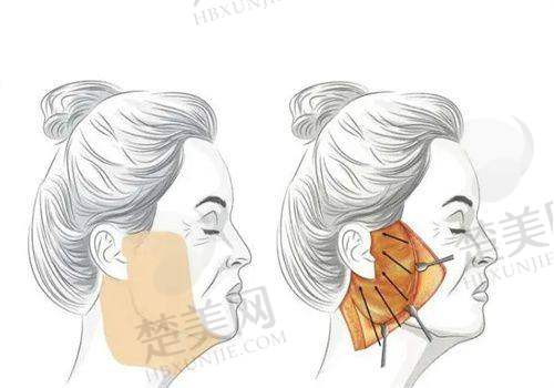 五、珠海九龙医疗美容整形医院