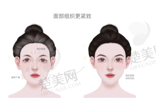 三、北京碧莲盛植发医院的预约方式