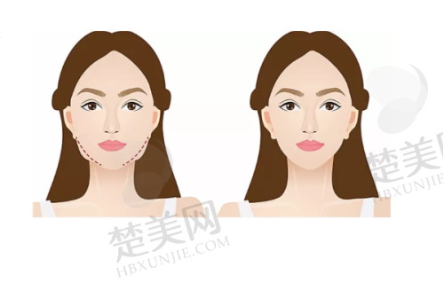 五、沈阳杏林整形医院微整形好医生——朱铎鹏