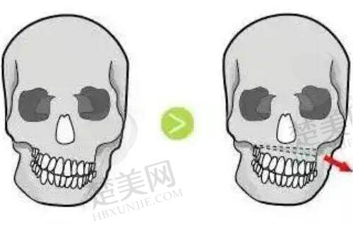 一、艺星整形美容医院多地电话公布