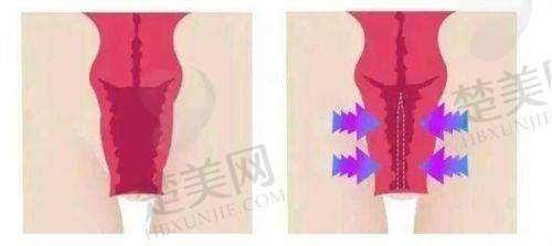 二、芜湖瑞丽医疗美容——项目丰富的正规医美场所