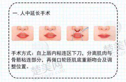 一、深圳福雅胡俊杰医生：专精经验多，多维度优势显著