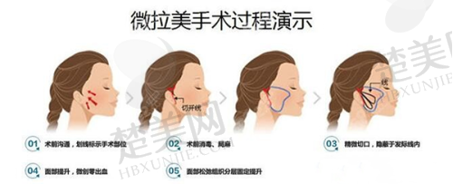 一、西安画美医院简介
