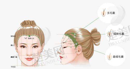 五、东莞科生植发医院：中韩合作的植发典范