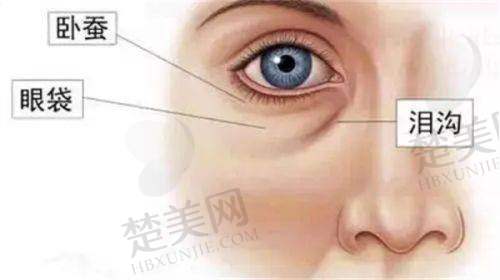 二、合肥艺星隆鼻价格全知晓
