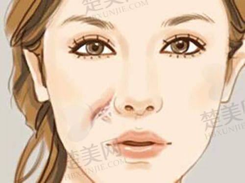 一、柳州华美整形医院是正规的吗？从资质看靠谱程度