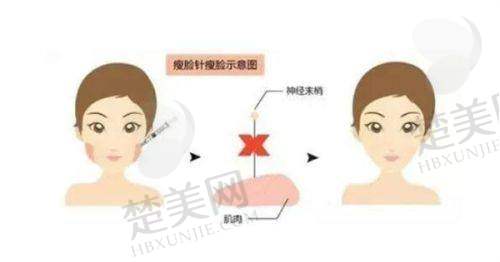 七、选择医院的注意事项