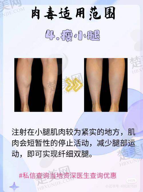 二、西安艺星整形美容医院