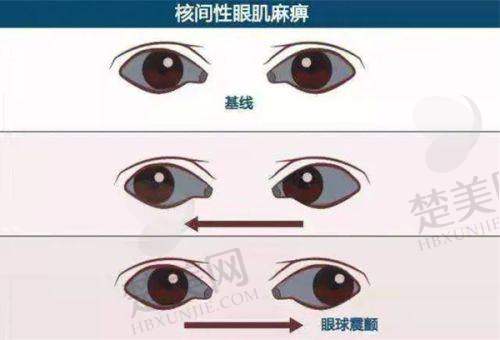 二、玉林华厦眼科医院地址在哪里啊之交通导航