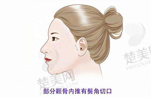 三、芜湖壹加壹整形——隆胸靠谱的正规门诊部