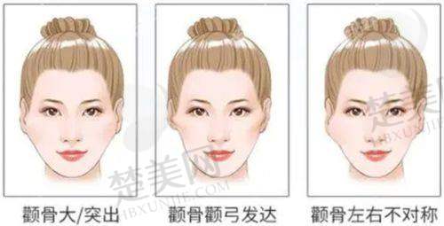 五、西安画美医院收费价格
