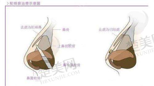 六、贵阳利美康整形美容医院是正规医院吗——综合评价定结论