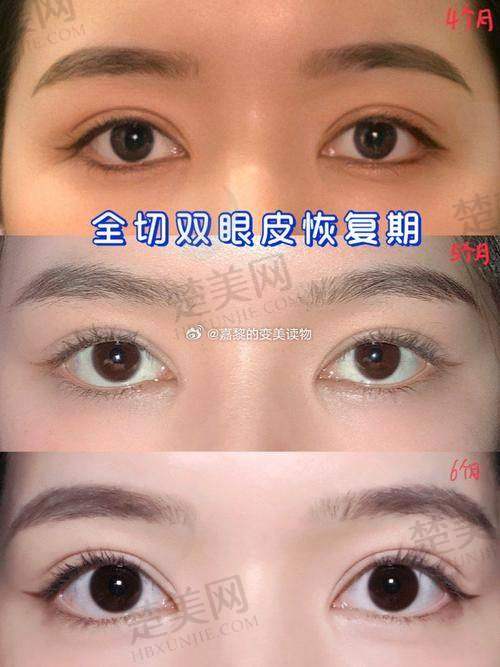 七、潘贰医生——广州颜美荟医疗美容医院