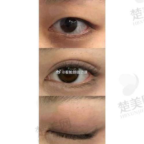 三、张诗若医生的修复理念