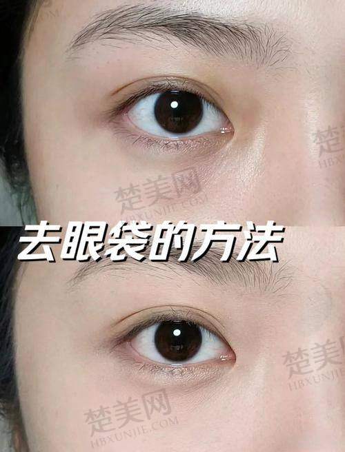 五、美诗沁的服务保护