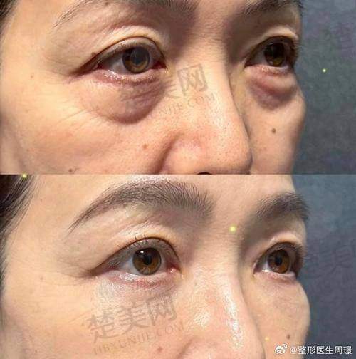 一、广州健丽医美地址与交通指南