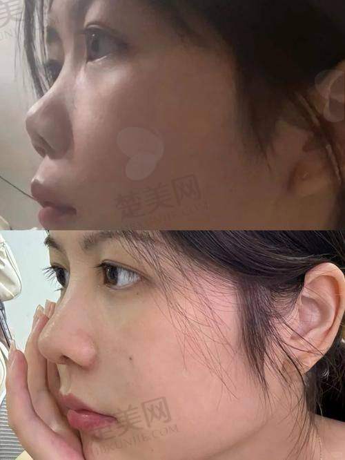 九、合肥安妮薇尔医疗美容李继银医生