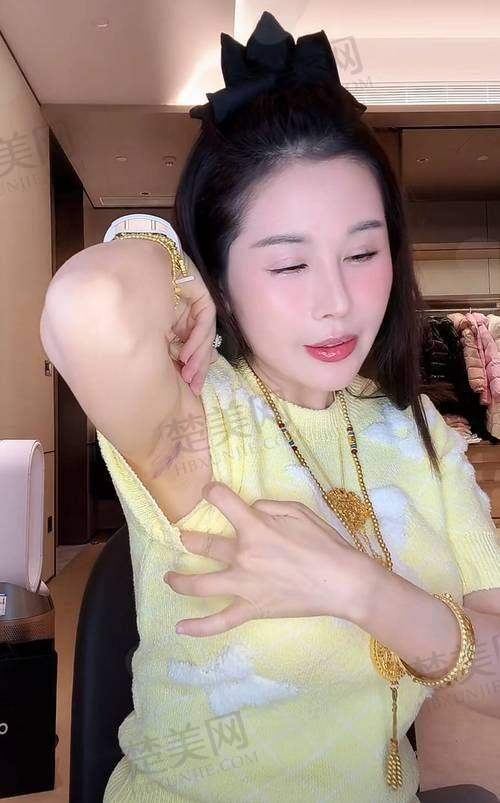 三、美波婷胶原丰胸的注意事项