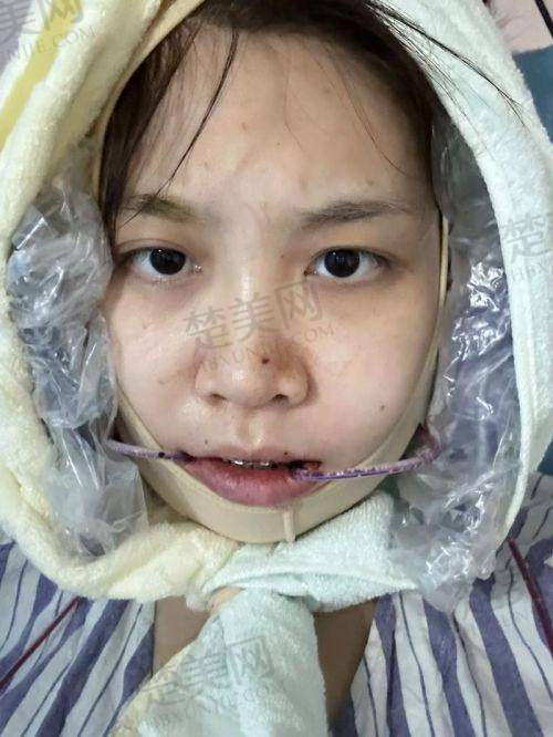 二、广州广大医院正颌手术医生团队实力如何？