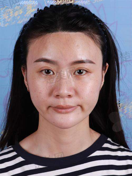 五、姜平医生——南方医 科 大学南方医院的主事医师