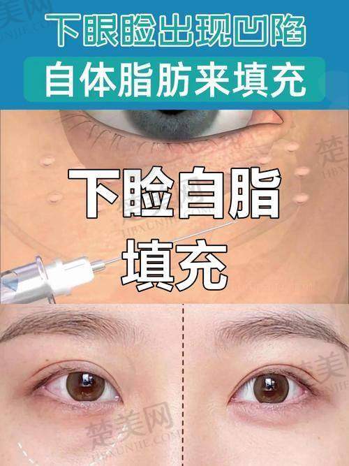 三、黑龙江超龙医疗美容医院姚盛雷医生