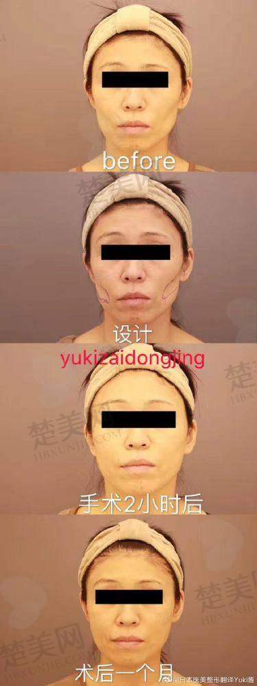 一、哈尔滨医 科 大学附属第二医院医生推荐