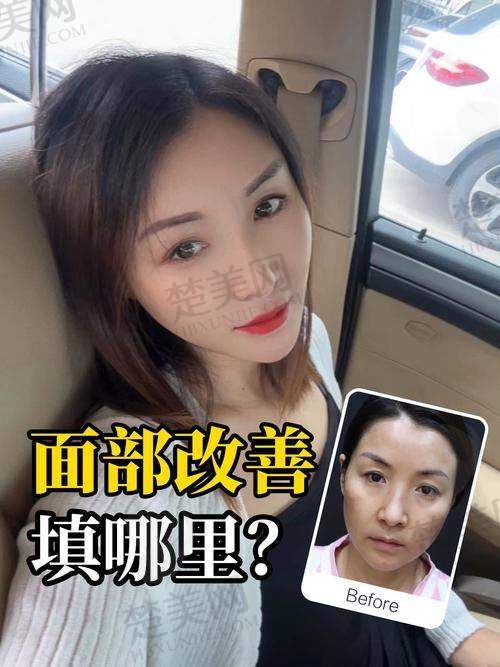 八、赵成利医生——广东省人民医院的主事医师