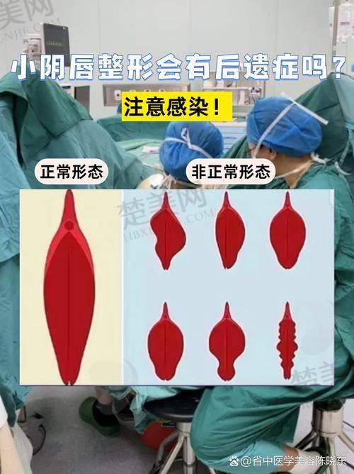 二、八大处李峰永医生私密紧缩手术技术优势