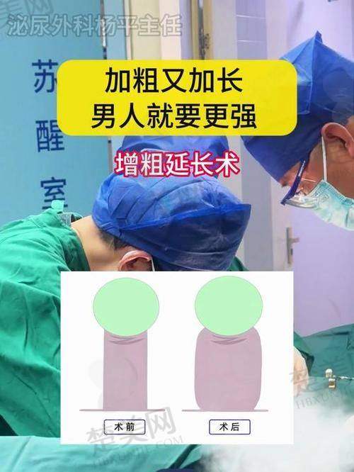 一、皖南医学校第一附属医院：芜湖玻尿酸男性增大注射要多少钱一次呢