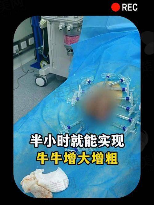 四、芜湖瑞丽医疗美容门诊部：芜湖玻尿酸男性增大注射要多少钱一次呢