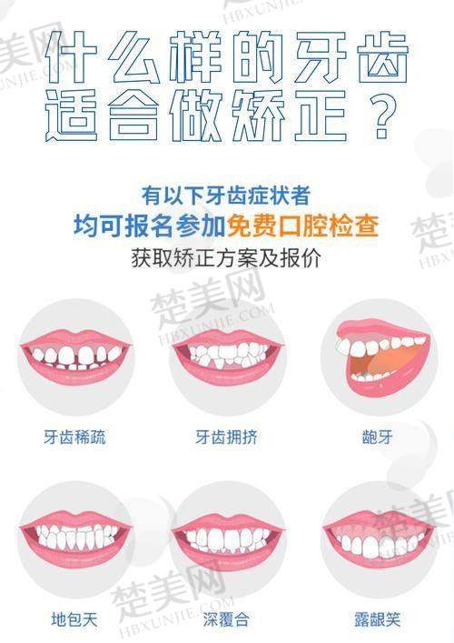 五、江门壹心维美口腔——专注品质的牙齿矫正机构