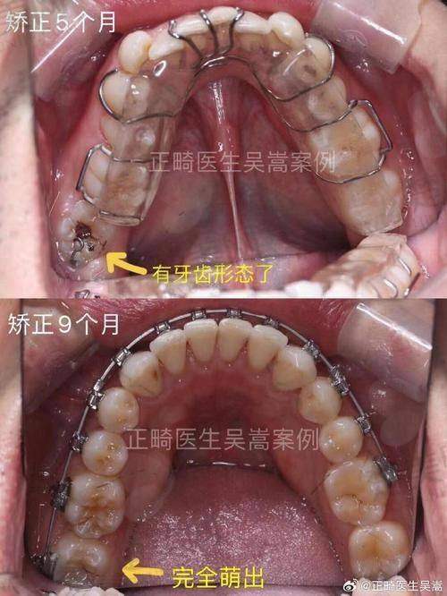 五、北京禾禾口腔门诊部黄帅医生口碑评价