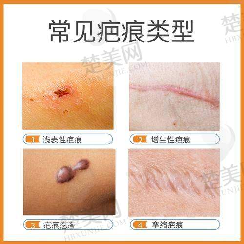 五、合肥亚典医疗美容：现代化机构的个性化去疤方案