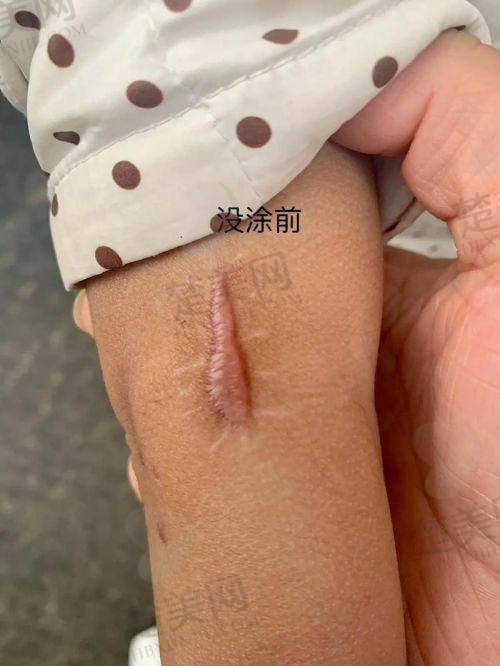 十一、合肥白领安琪儿整形