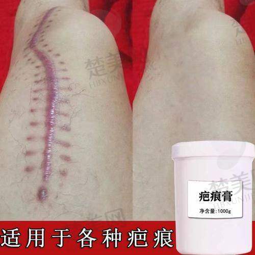 三、合肥肤康皮肤病医院：中医特色的去疤专科医院