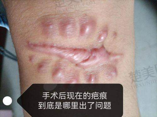 二、合肥艺星医疗美容医院：规模大科室全的去疤之选