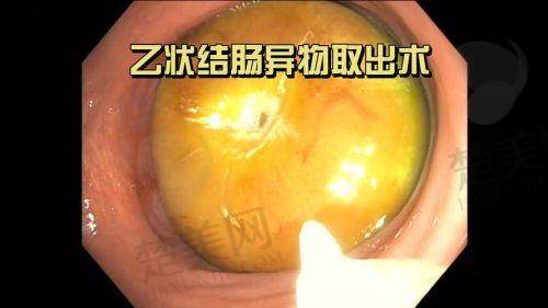 二、钟杰光医生：整形外科的实力担当