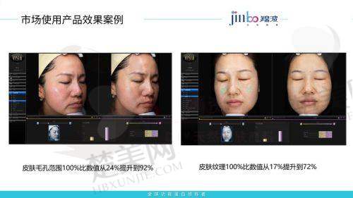 七、合肥前颞区胶原蛋白填充排名前十医院之合肥刘大夫美容整形门诊部