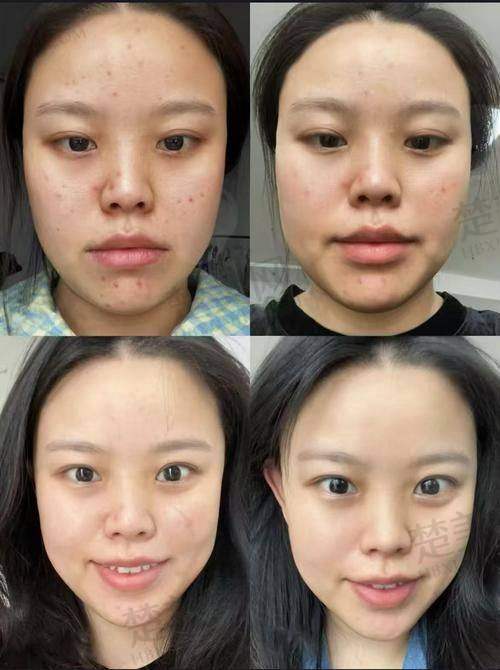 五、如何选择适合的医院