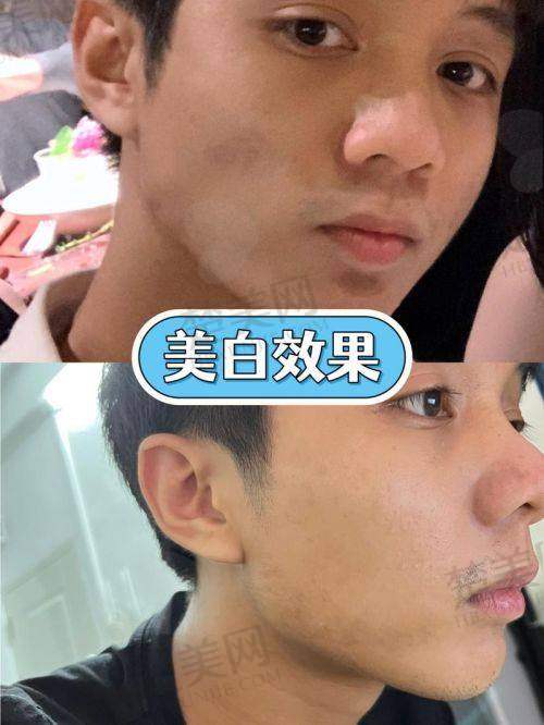 八、深圳源美医疗美容医院——上班族的贴心之选