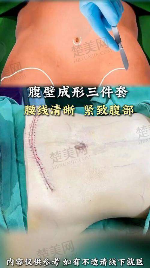 二、常见顾虑及实际情况