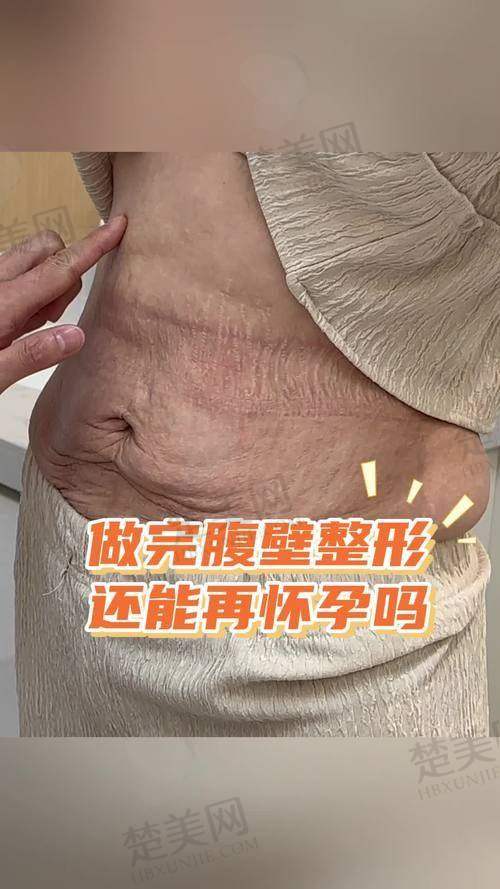 三、手术感受分享