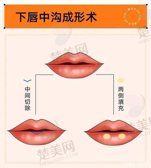 五、西安国际医学中心整形美容医院——西安唇部整形哪个医院做的比较好点之专精典范