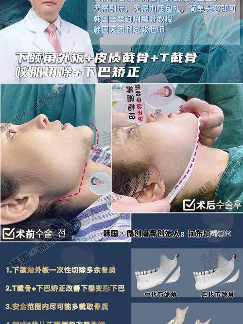 二、崔荣达医生擅长项目
